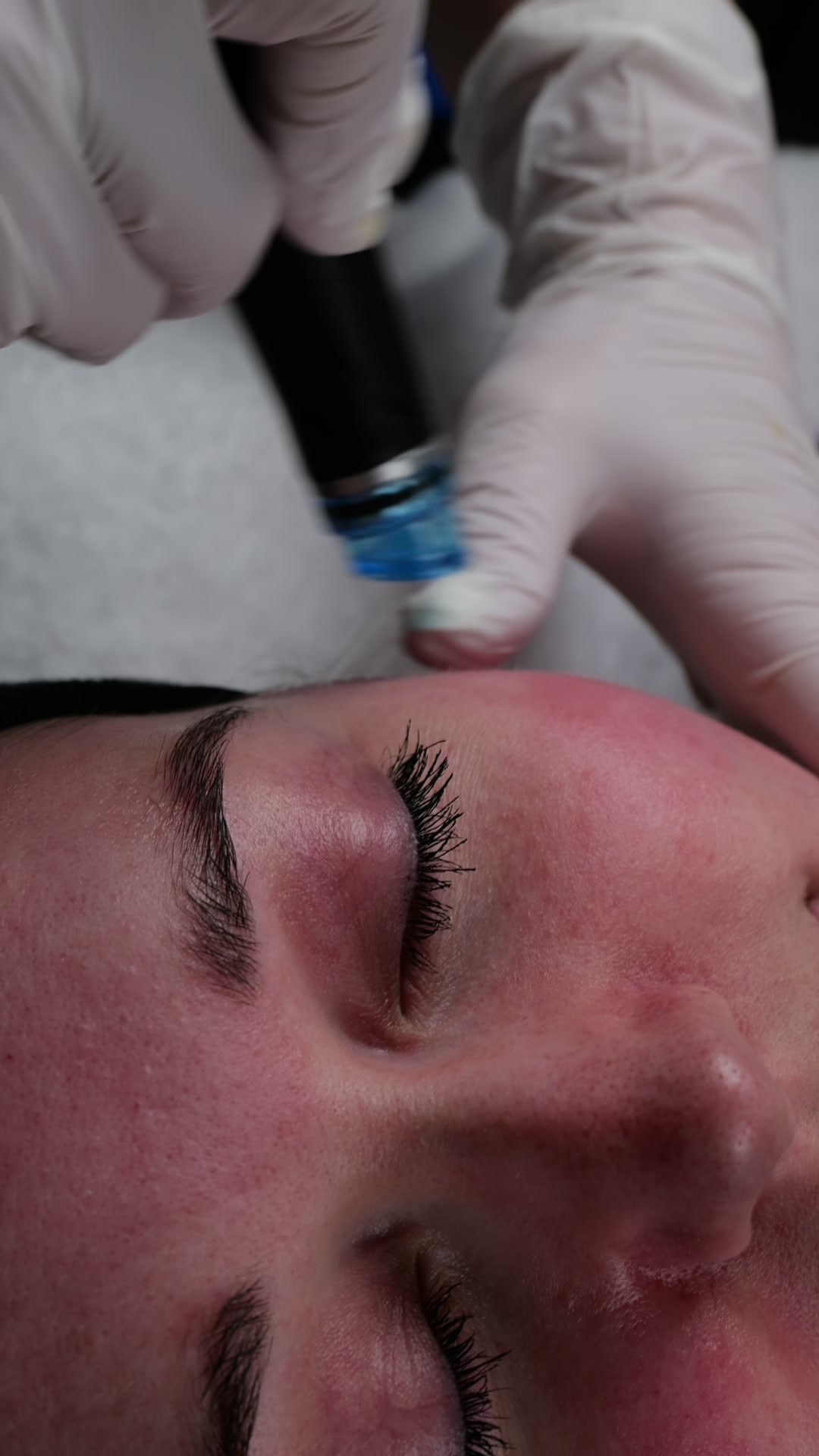 HydraFacial behandling Avisen Beauty Upplands Väsby