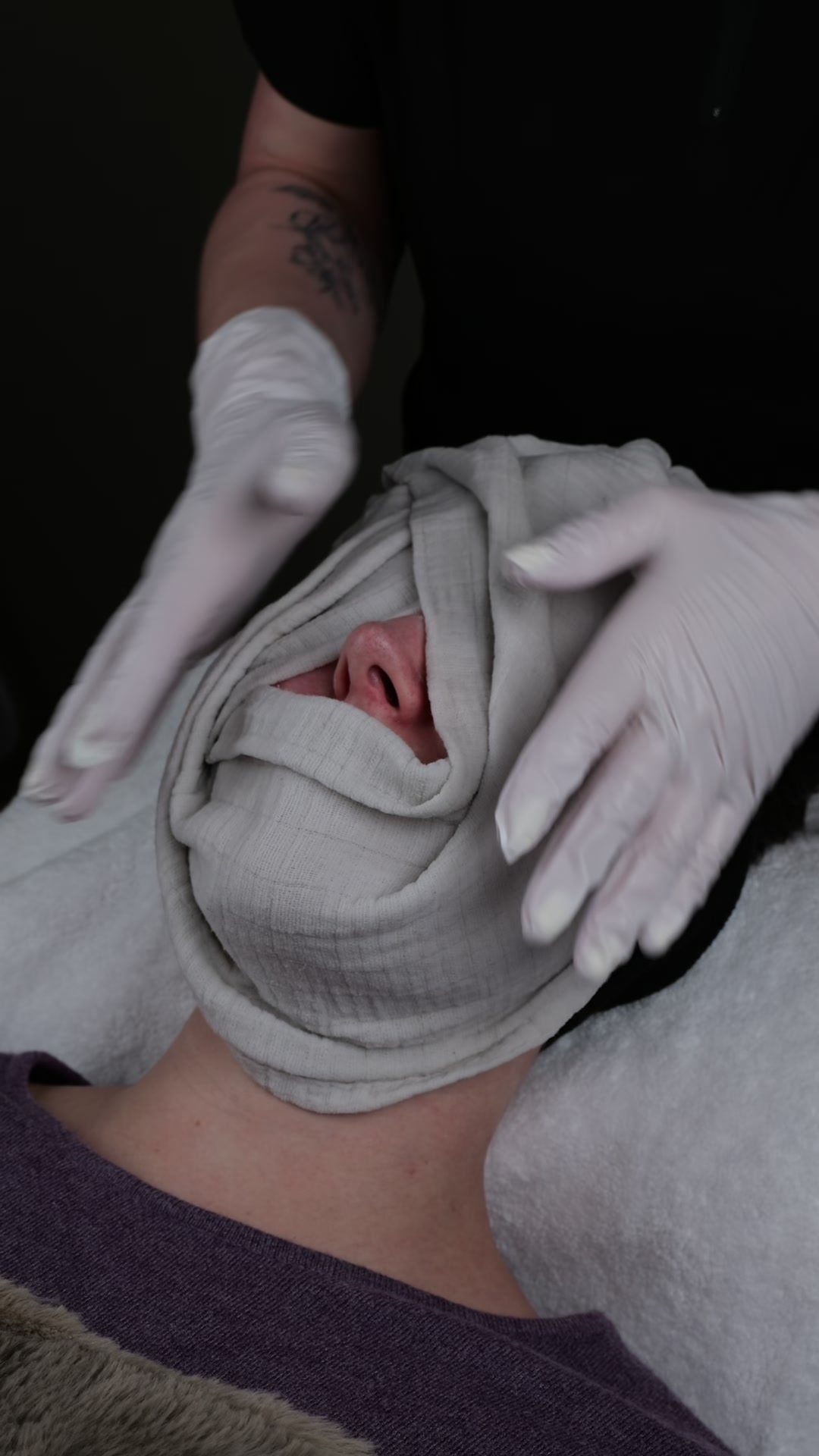 HydraFacial resultat 1 Avisen Beauty